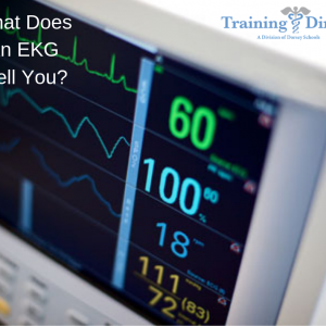What does an EKG Test for?