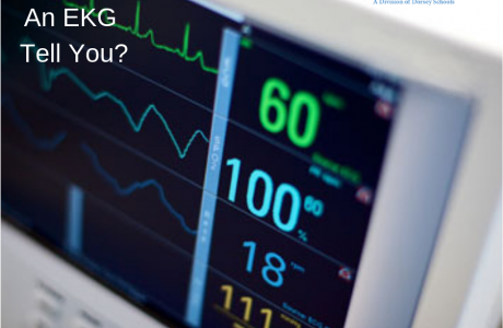 What does an EKG Test for?