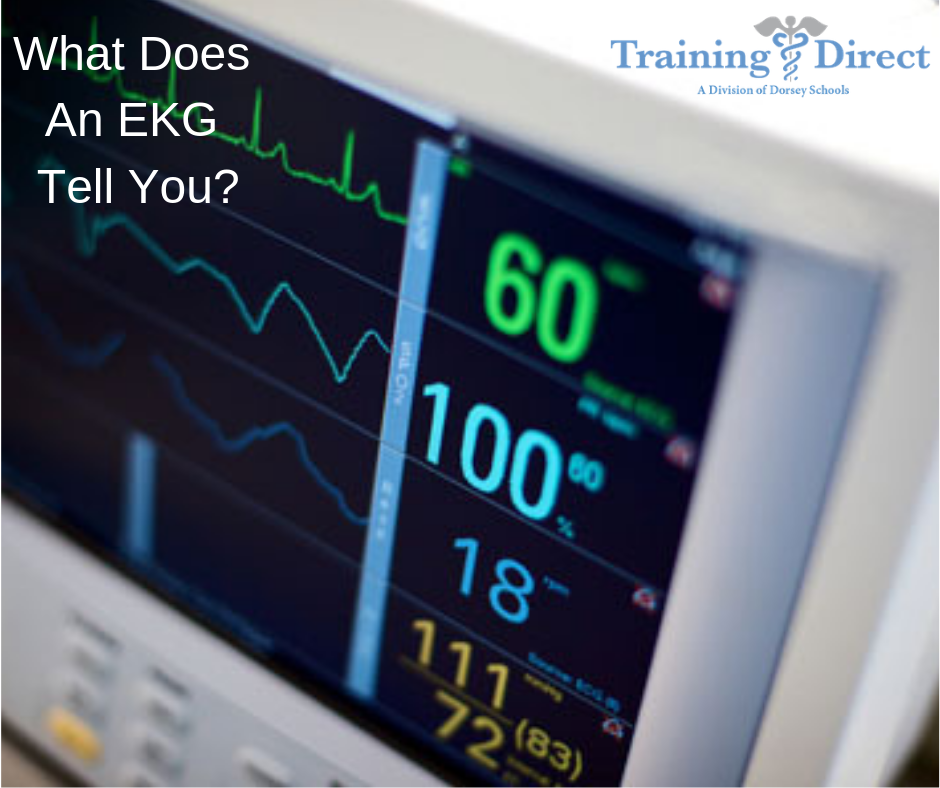 What does an EKG Test for?