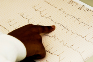 what is a an ekg technician