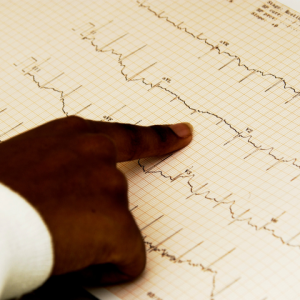 what is a an ekg technician